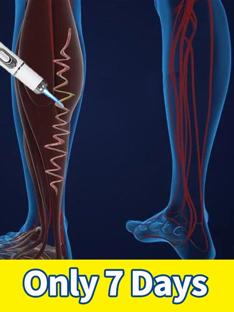 Generation-2 Laser Treatment – Reduces Spider & Varicose Veins in 7 Days, Non-Invasive Vein Care