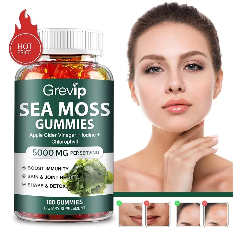 ✨ Sea Moss Gummies 5000mg – Immunity, Thyroid & Beauty Support